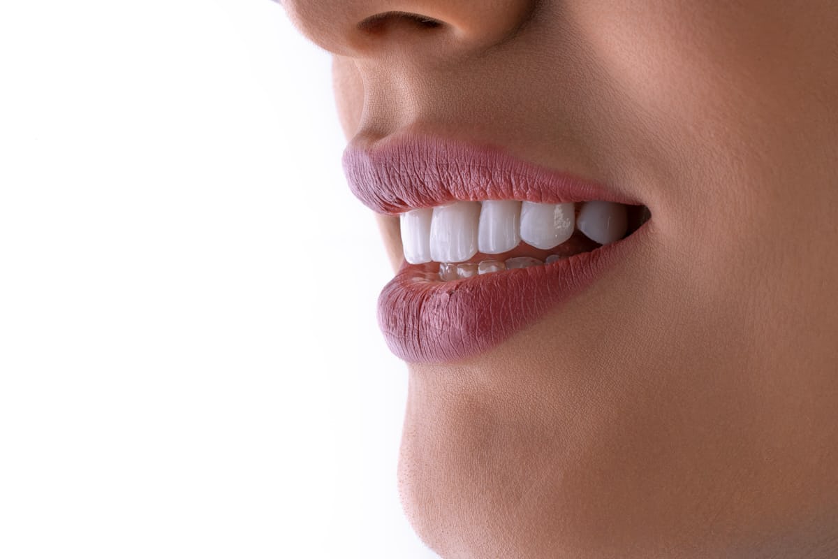 Trusted Dentist in Mount Gambier | Confident Smiles