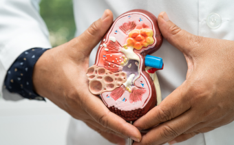 APOL1 Mediated Gene Kidney Disease | APOL1 Nephropathy