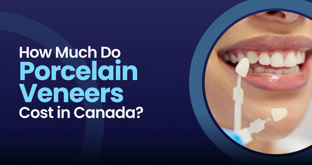 How Much Do Porcelain Veneers Cost in Canada in 2026? - Dr Gillmore