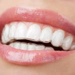Cost of Braces in Chennai profile picture