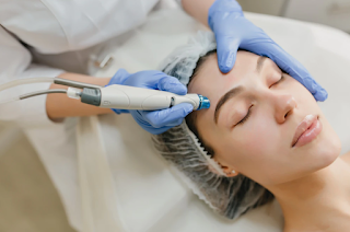 Hydrafacial Treatment In Vaishali Ghaziabad: A Gentle Approach to Cleaner, Healthier-Looking Skin