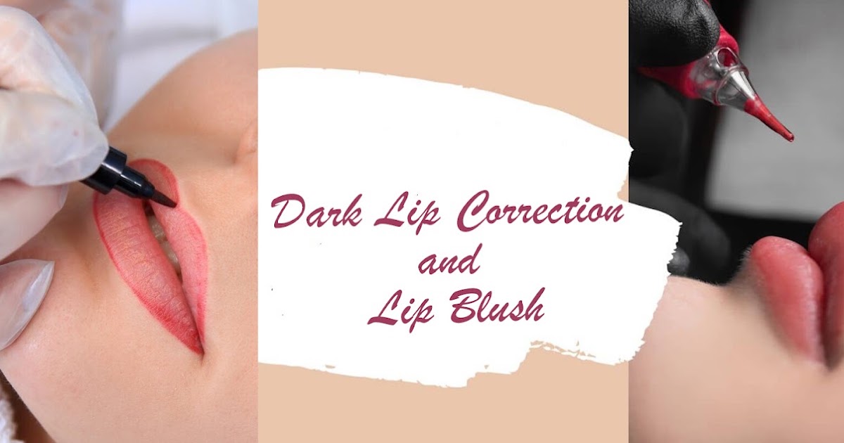 Lip Neutralisation Mumbai for a More Balanced Lip Tone