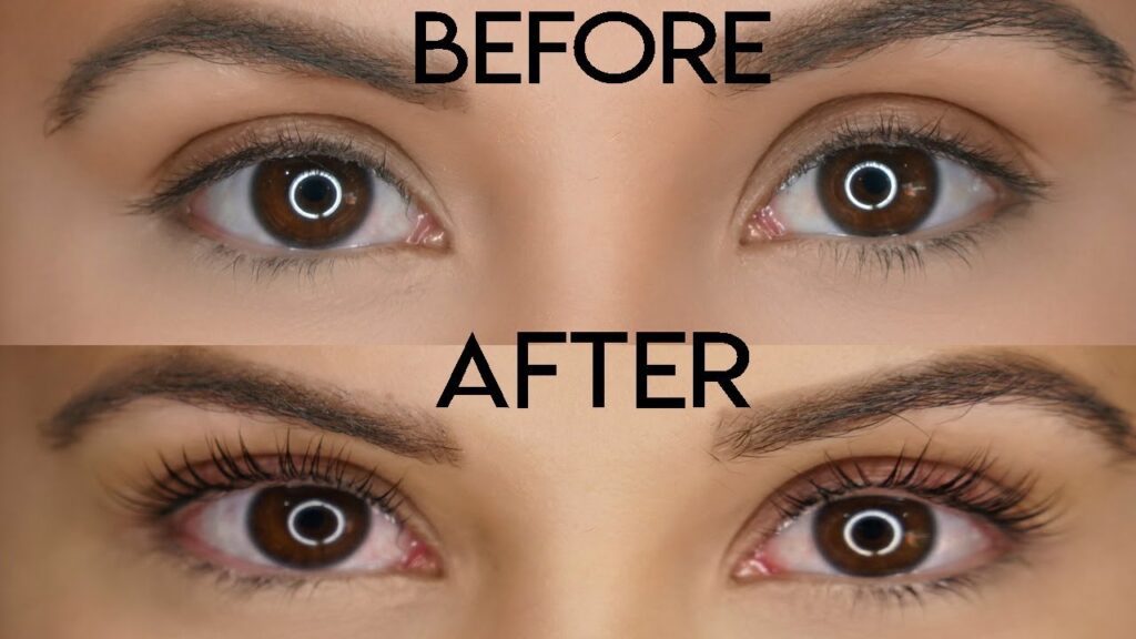 Lash Lift & Lip Lightening in Mumbai: What to Know