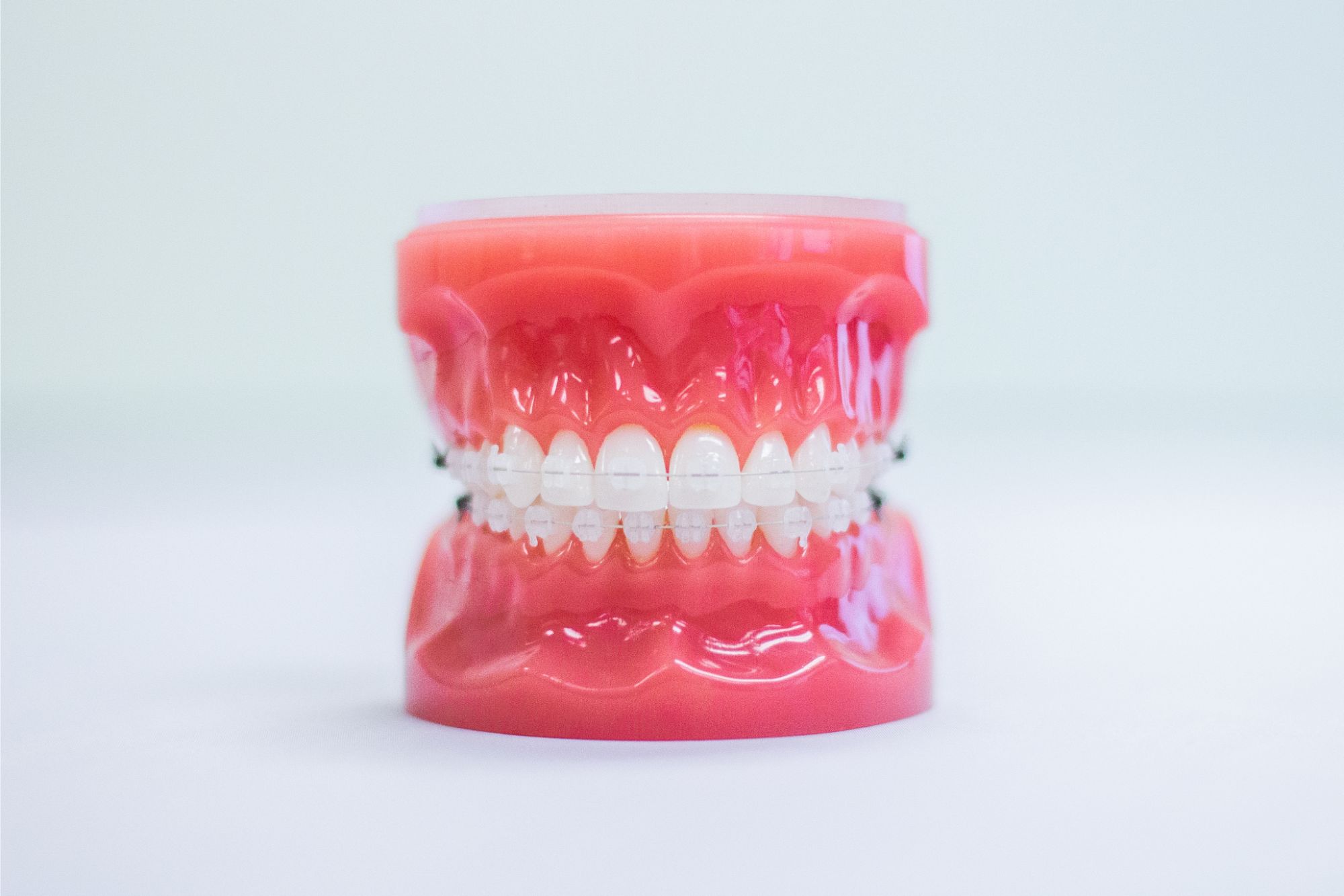 Braces | Stillwater & St. Croix Falls, MN | Orchin + Orchin Orthodontics