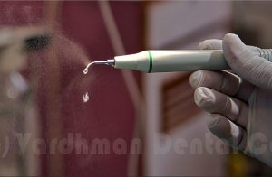 Best Dentist in Pitampura | Vardhman Dental Care