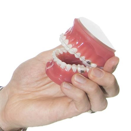 Moorhead Braces | Detroit Lakes Braces | Braces Detroit Lakes | Moorhead Invisalign | Detroit Lakes Invisalign | Invisalign Moorhead | Invisalign Detroit Lakes