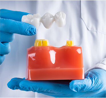Dental Bridges in Dublin, CA